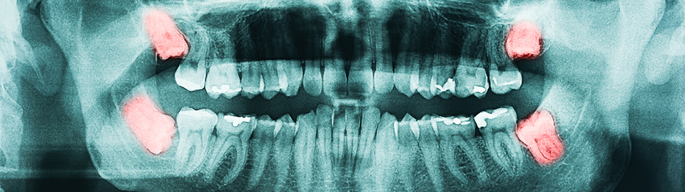 SEOSAN GAON DENTAL CLINIC