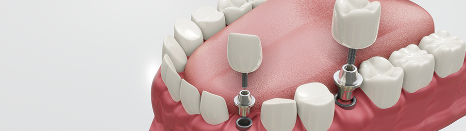 SEOSAN GAON DENTAL CLINIC
